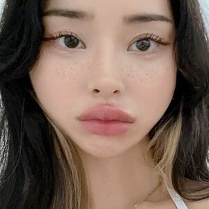 aloedvni
