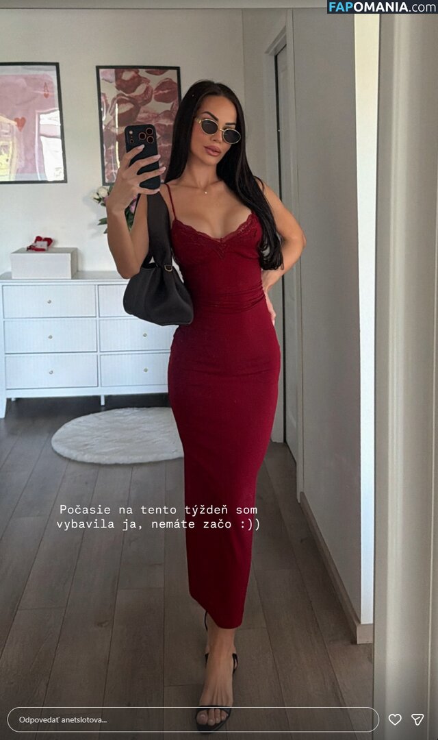 Anet Slotova / anetslotova Nude OnlyFans  Leaked Photo #1