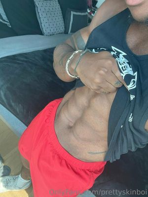 prettyskinboi